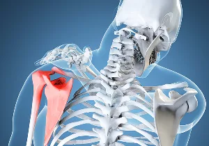 shoulder dislocation.jpg
