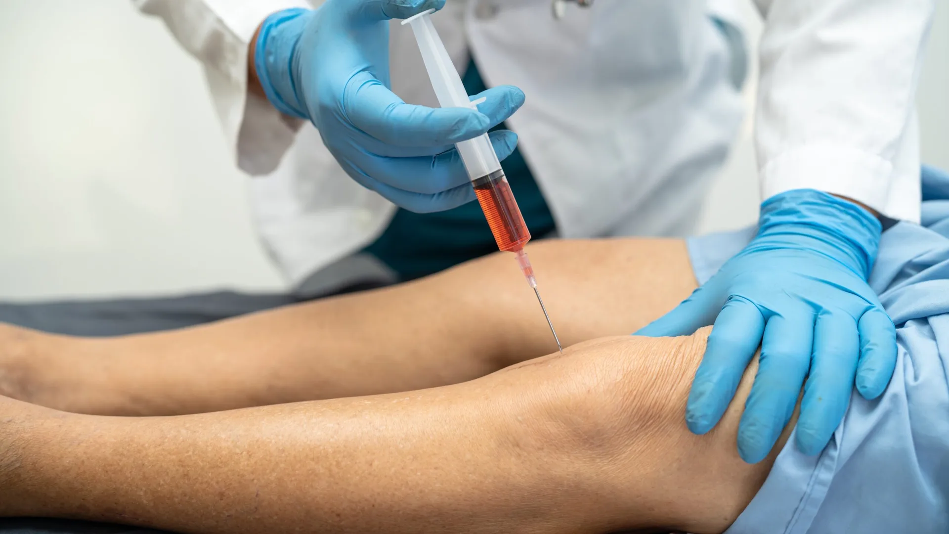 PRP (Platelet-Rich Plasma)