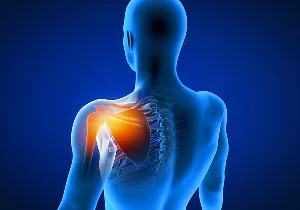 Frozen Shoulder.jpg