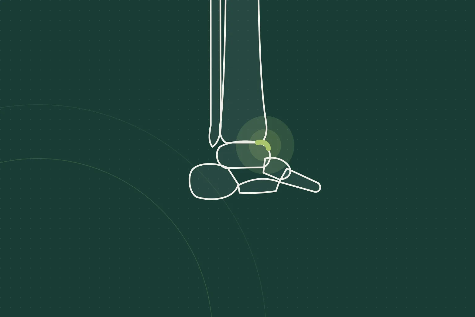 Illustration of the affected joint, not a photograph of the patient
