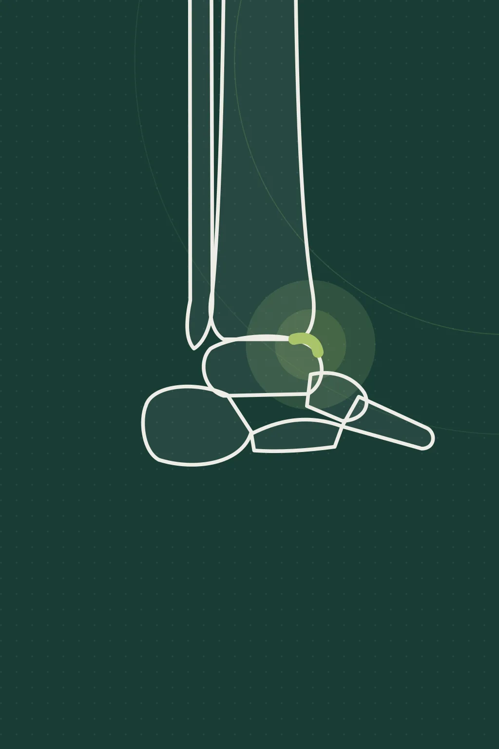Illustration of the affected joint, not a photograph of the patient