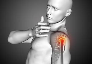 Bursitis and tendinitis.jpg