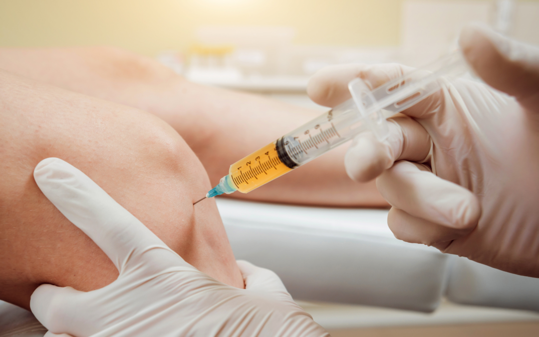 PRP Injections for Knee Osteoarthritis: what to expect?