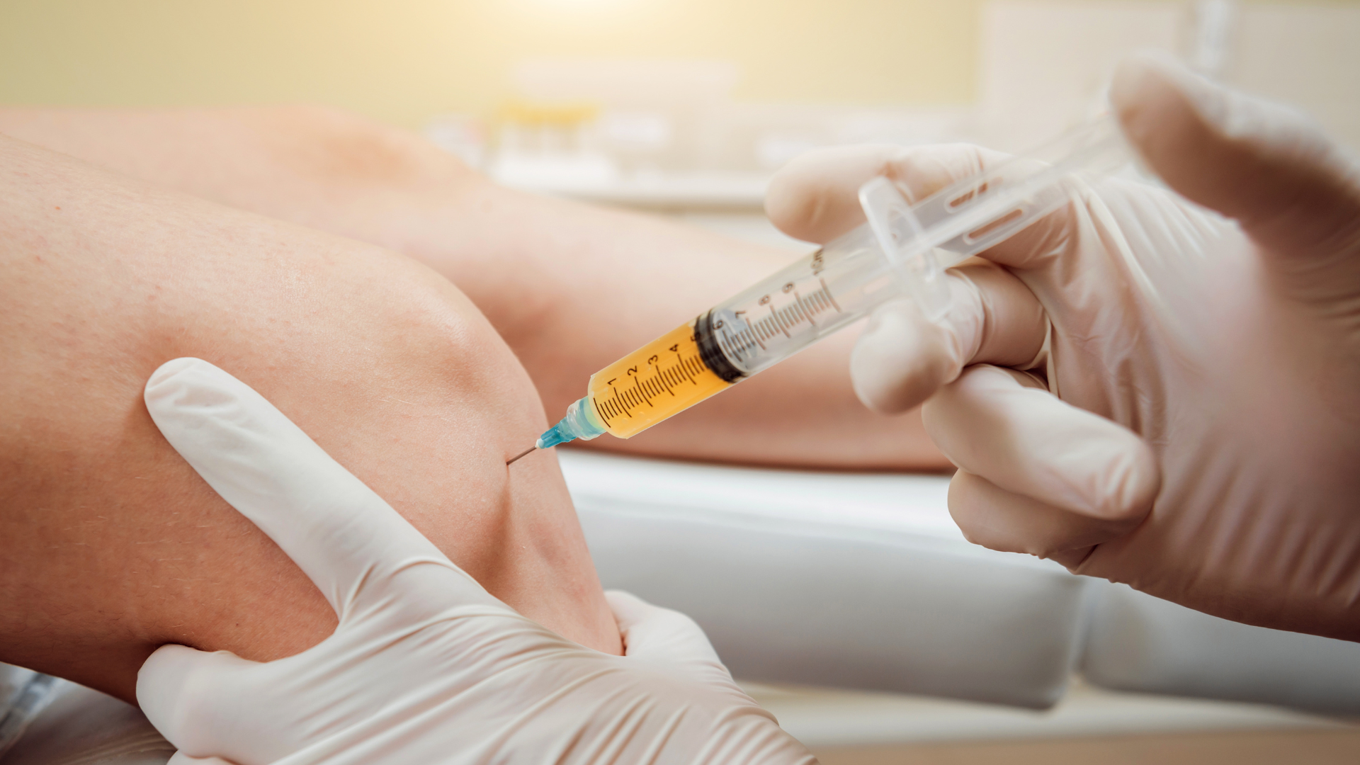 PRP Injections for Knee Osteoarthritis