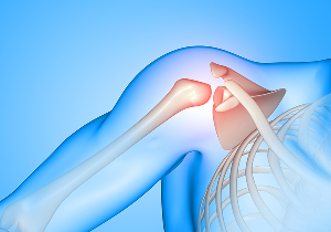 Rotator Cuff Injuries.jpg