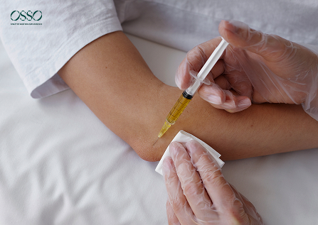 PRP Injections for Knee Osteoarthritis: what to expect?