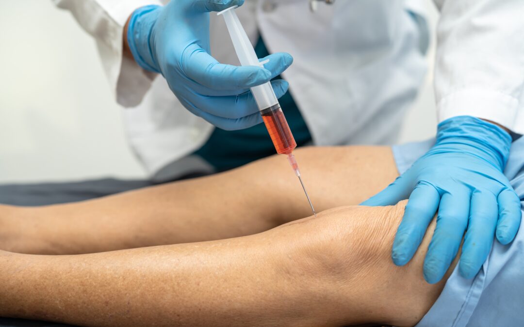 PRP Therapy for Joint Pain: How It Works, Benefits & Recovery Timeline