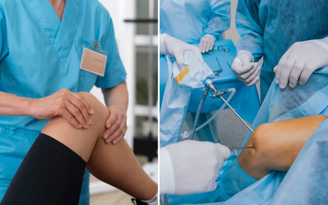 ACL Tear Treatment: Non-Surgical vs Surgical – Which Is Right for You?